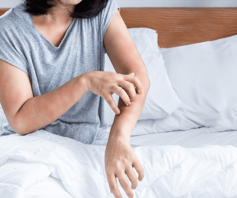 get rid of bedbugs sunderland uk